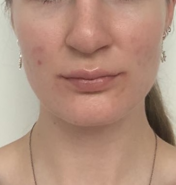 state of skin after usage