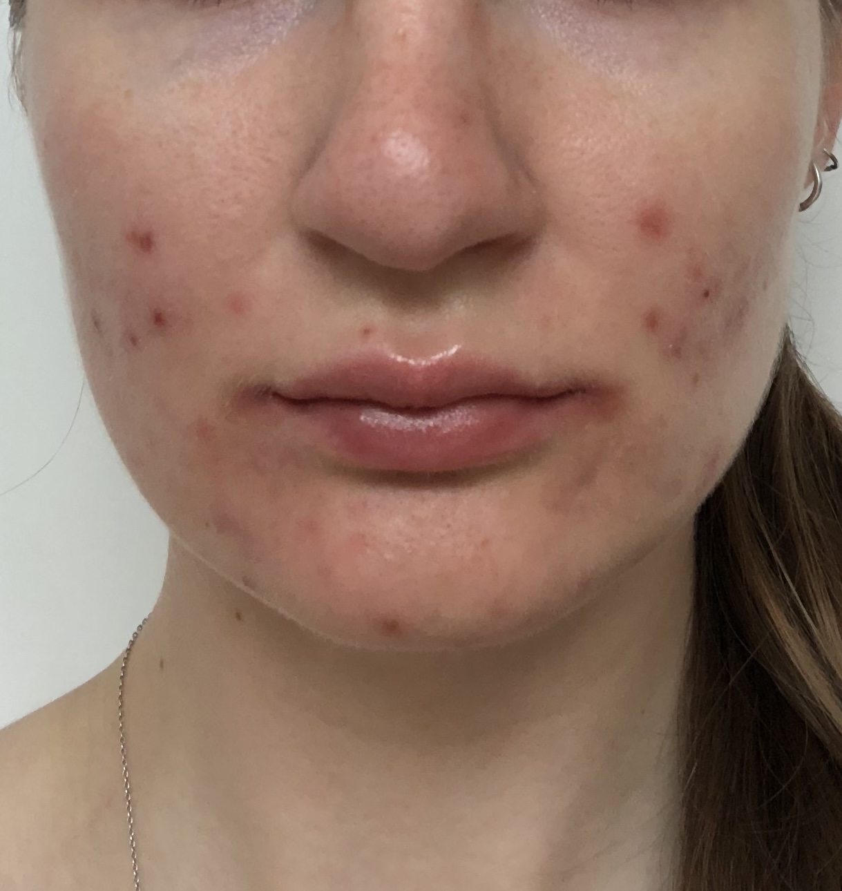 state of skin before usage