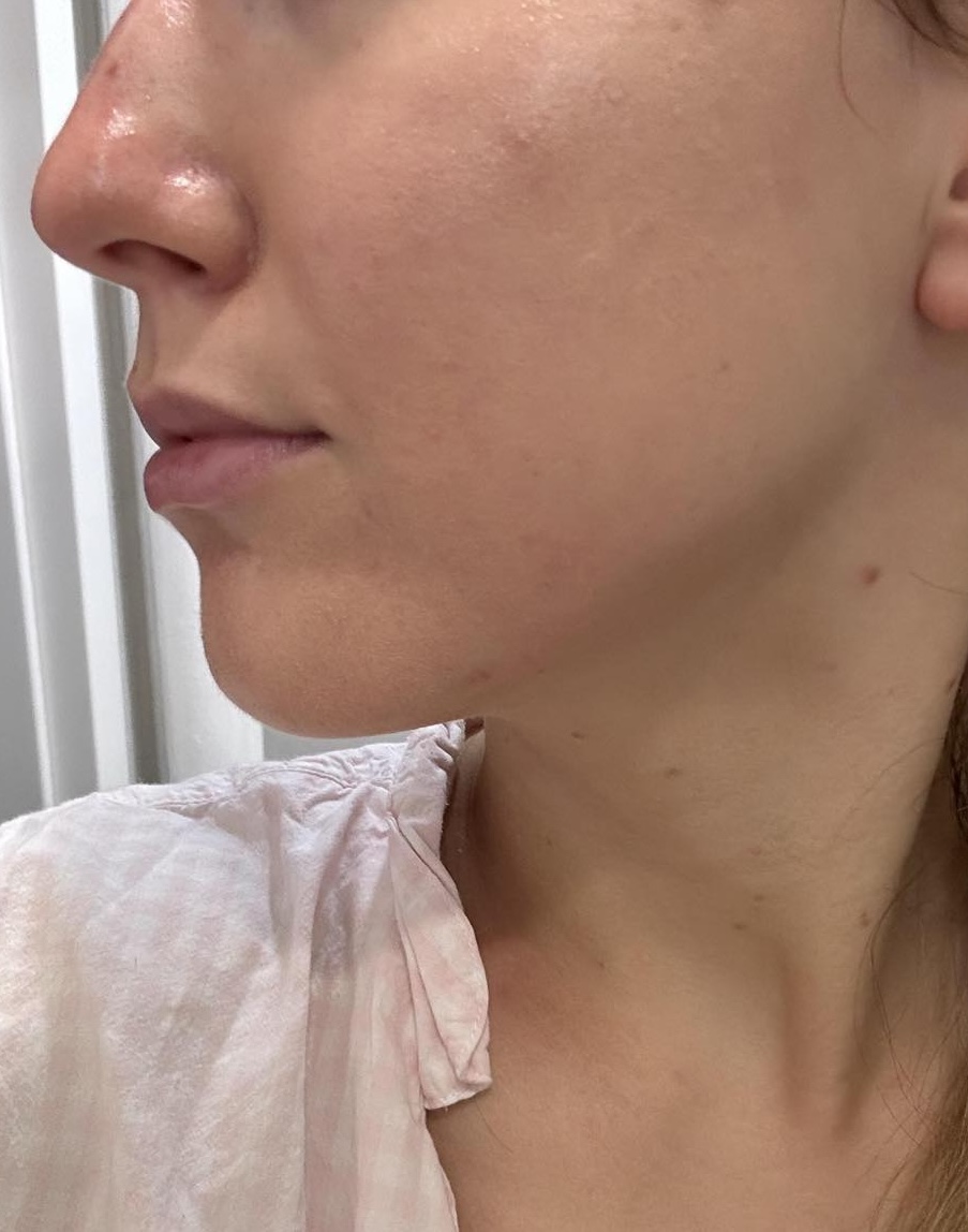 state of skin after usage